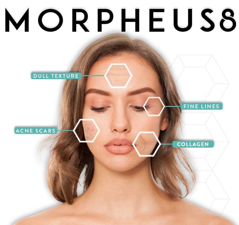 Unveiling the Magic of Morpheus8: A Revolutionary Facial Treatment