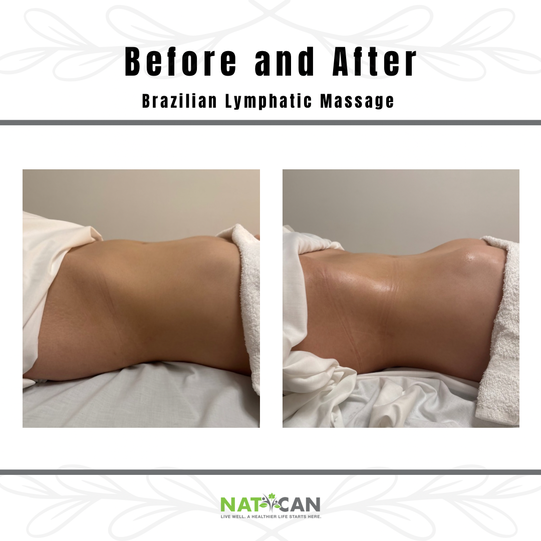 Lymphatic Massage