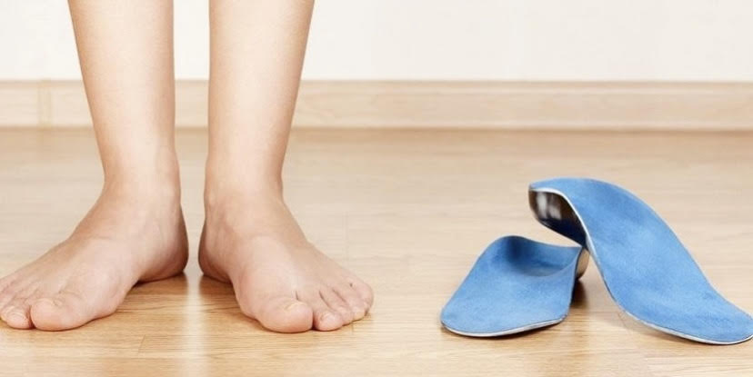 A person in bare feet stand next to their custom orthotics, designed to help treat their knee pain and shin splints